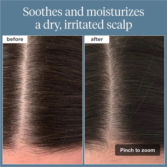 NIB Briogeo Scalp Revival Rosemary Pre-Wash Scalp and Hair Oil - Picture 2 of 6